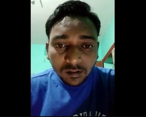 रांची के संतोष कुमार को 4 महीने में क्षार सूत्र से फिस्टुला की समस्या से मिली राहत